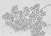 Photo of microcystis aeruginosa
